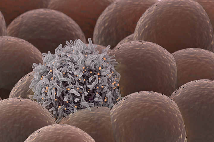 The aberrant N-glycosylation of tumor cells is now fully recognized as a novel immune checkpoint, masking tumor cells from the immune system via the formation of complex abnormal glycan patterns operating as a shield.

Our glycocalyx modifiers target the aberrant N-glycosylation directly to the source through the selective inhibition of ...